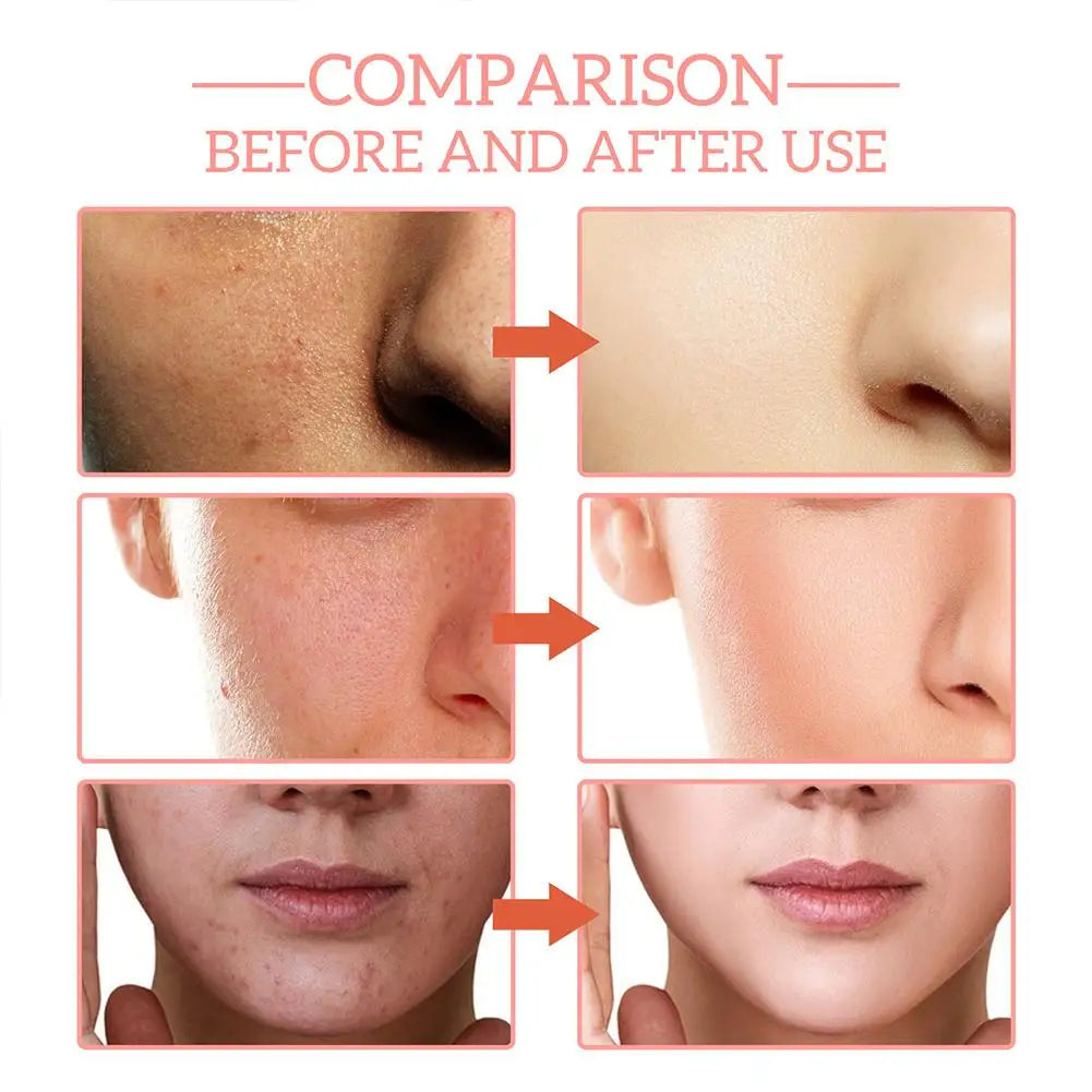 Vitamin C Hyaluronic Serum