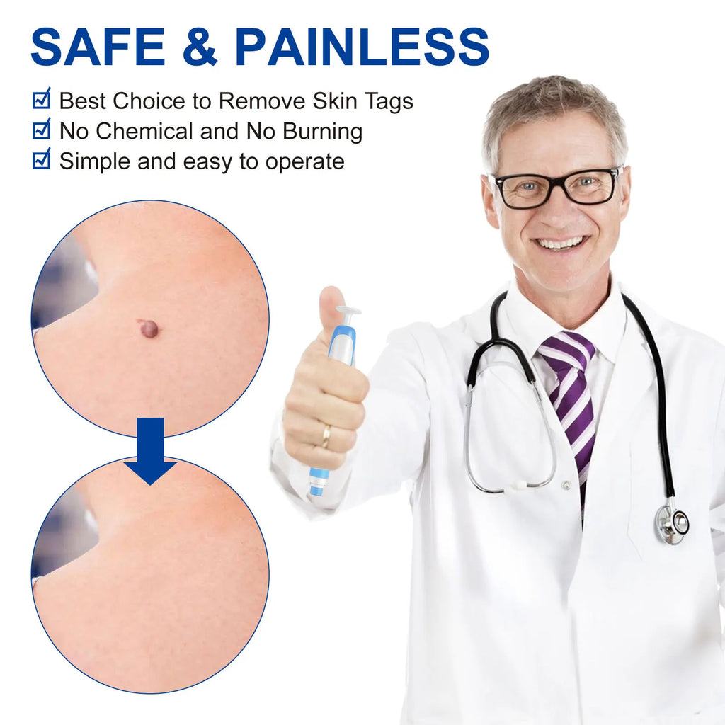 Advanced Skin Tag & Wart Remover