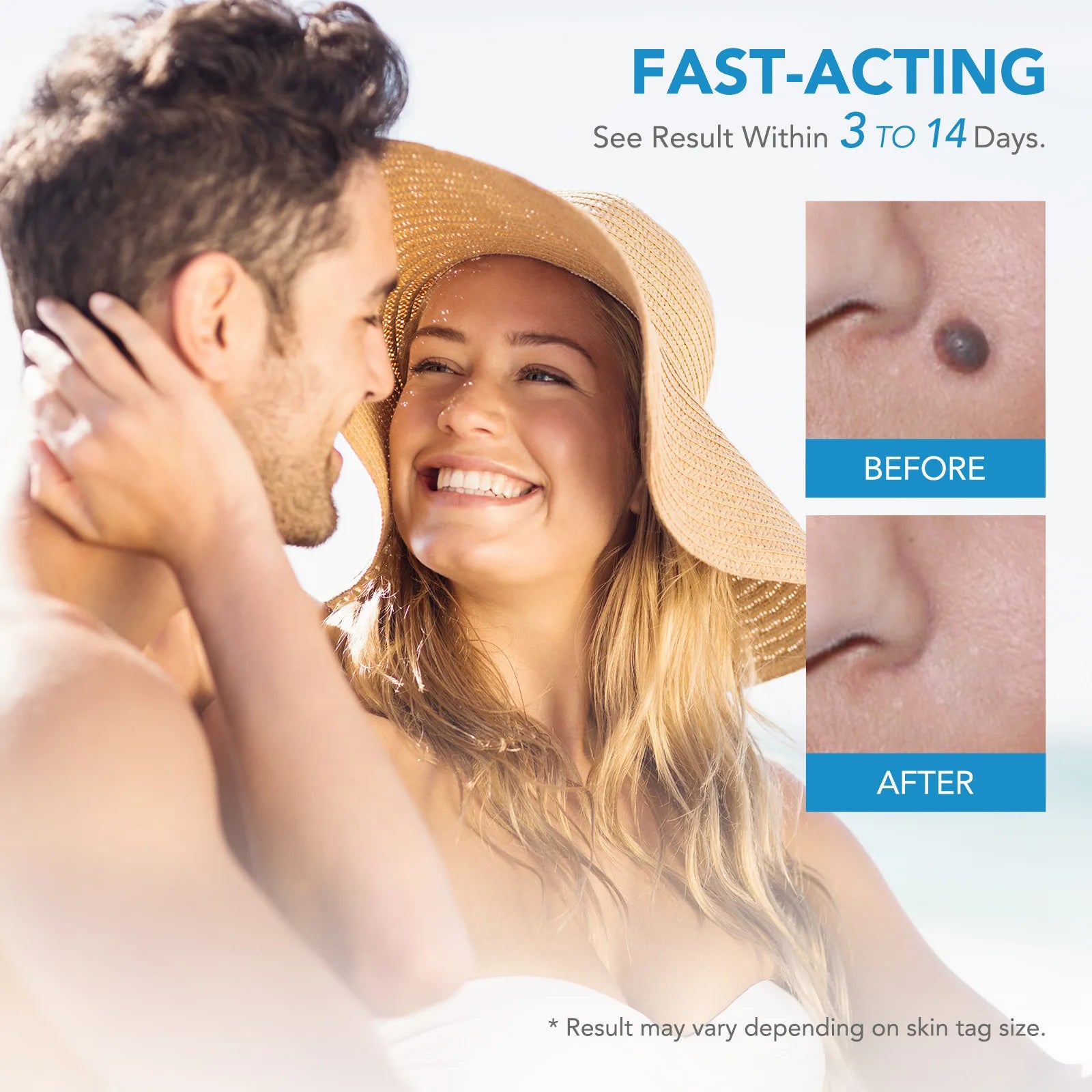 Advanced Skin Tag & Wart Remover