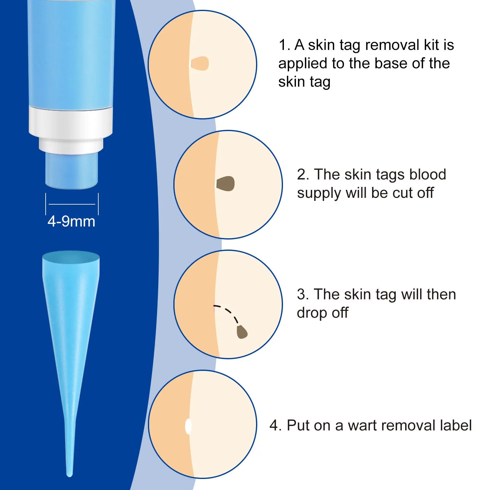 Advanced Skin Tag & Wart Remover