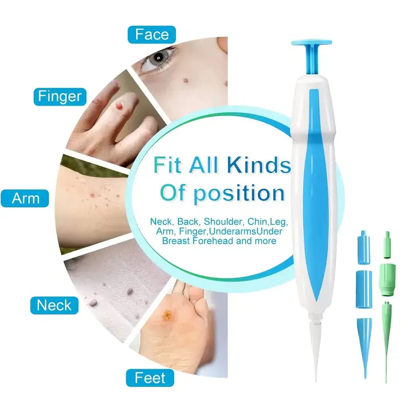 Advanced Skin Tag & Wart Remover