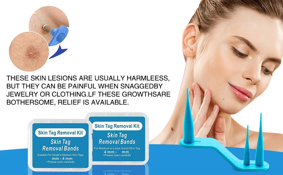 Advanced Skin Tag & Wart Remover