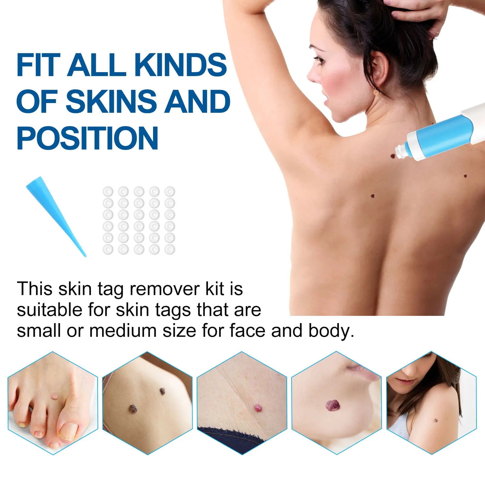 Advanced Skin Tag & Wart Remover