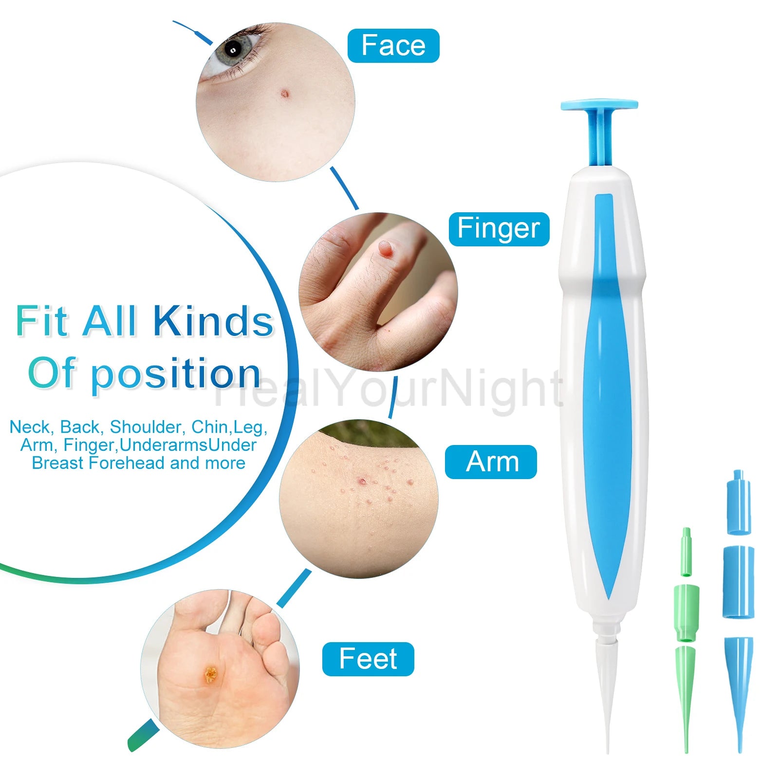 Advanced Skin Tag & Wart Remover