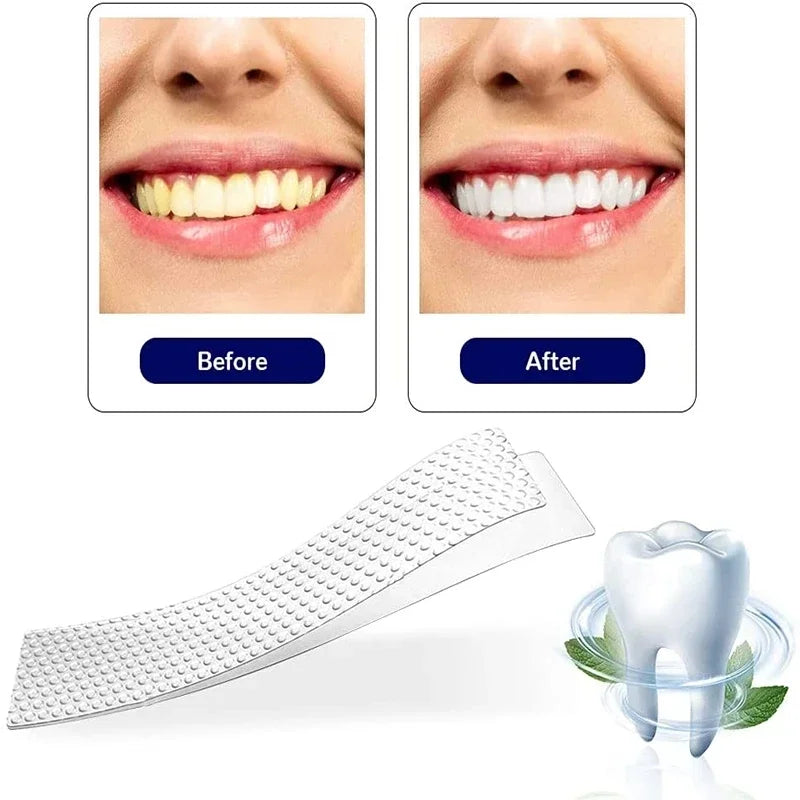 5D Whitening Strips