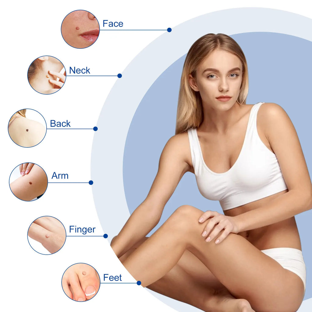 Advanced Skin Tag & Wart Remover
